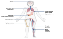 上海世界医药合同定制服务展 ICSE China癌症治疗的新靶点：IL-1RAP