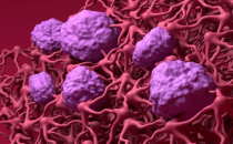 CPHI 上海制药原料展快讯 GSK 将推进神经退行性疾病的抗体药物