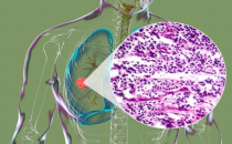 上海世界医药合同定制服务展 ICSE China，CPHI 2025制药原料展简讯 创新方法改善癌症免疫治疗