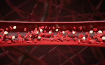 深圳国际医疗旅游展览会 CMTF重症血液净化：危重患者的生命防线