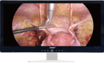 北京国际医疗器械展览会 CMEH BEIJING展商推荐：沈阳沈大内窥镜有限公司