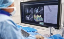 上海医疗器械展丨微创电生理压力脉冲电场消融导管上市；飞利浦推出AI加持的全新TEER修复方案&hellip;&hellip;